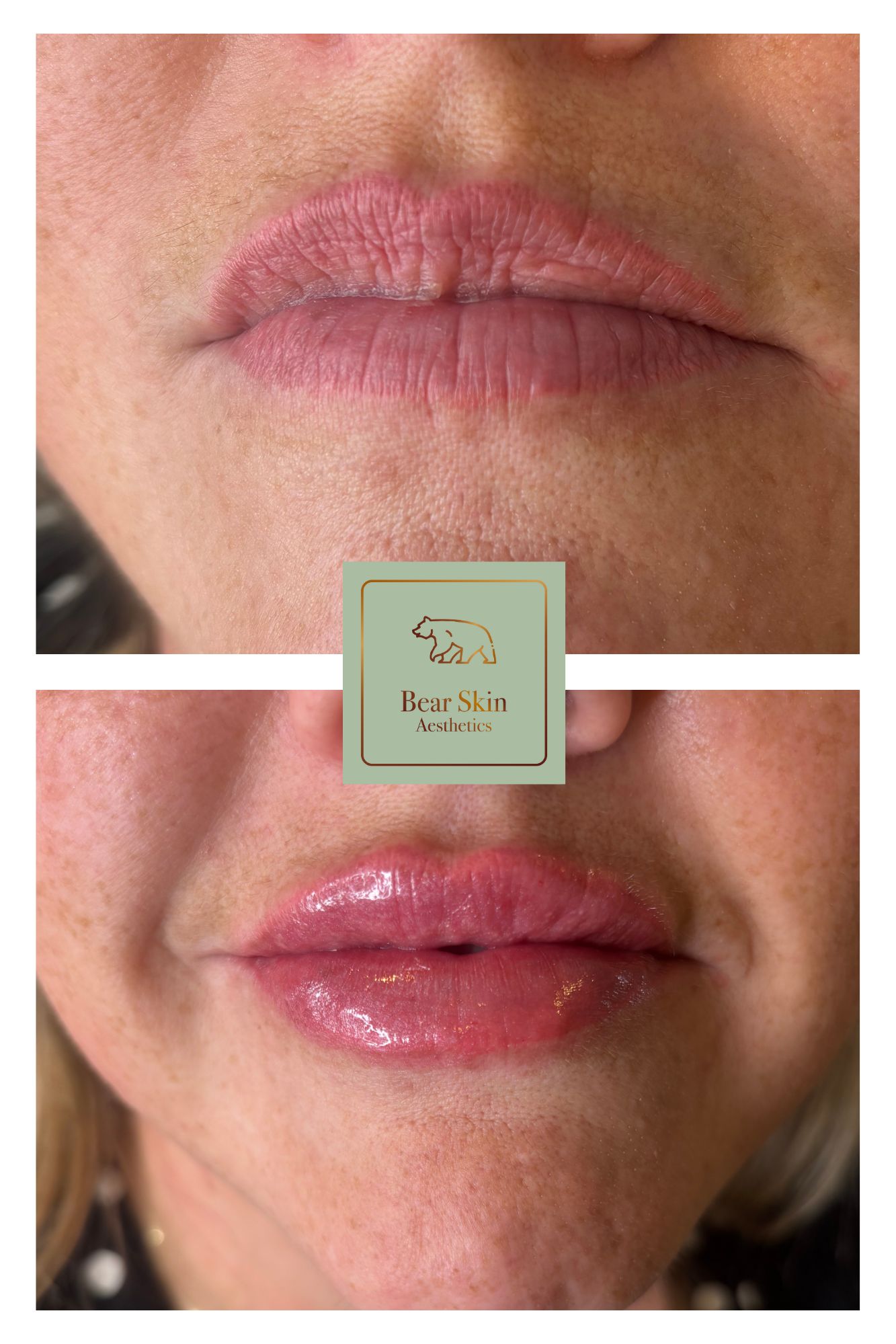 Before and after — Hydrated, glossy lips