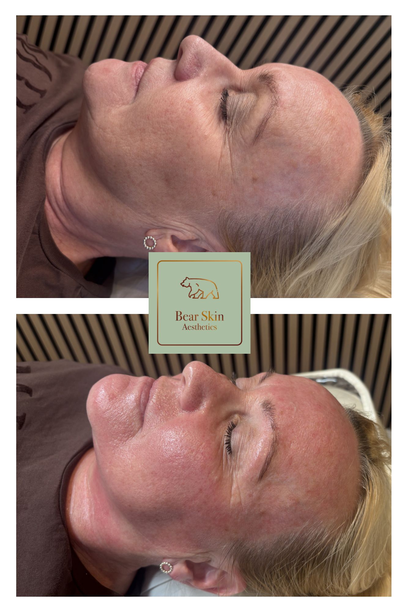 Before and after — Radiance & glow